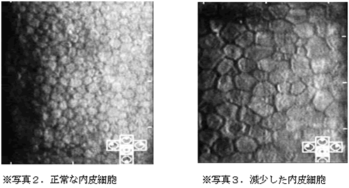 写真：角膜内皮細胞